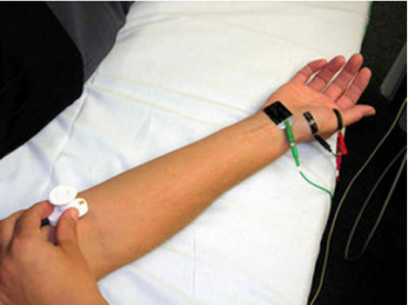 ihlová elektromyografia