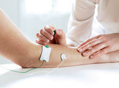 ihlová elektromyografia